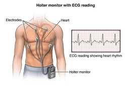 Holter Monitor from KREND MEDICAL EQUIPMENT TRADING LLC