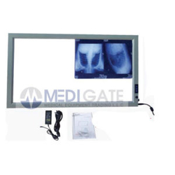 X-ray Film Viewer from MEDIGATE MEDICAL EQUIPMENT TRADING L.L.C