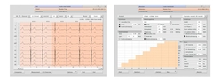  Software for Resting / Stress ECG