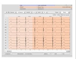 CARDIAC DIAGNOSTIC SOFTWARE from MAXVALUE TRADING LLC
